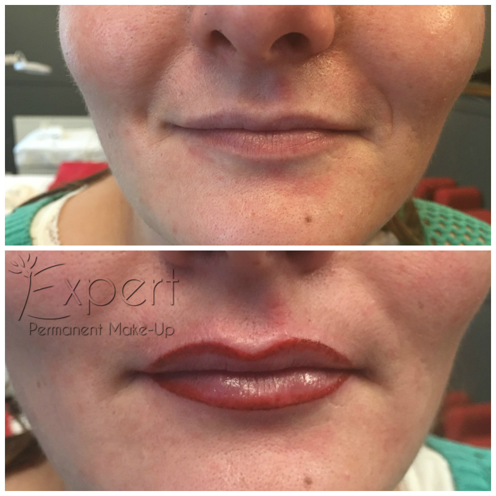 Permanent Make-up - Lippen Vorher-Nachher-Bild 7