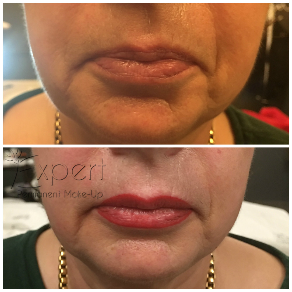 Permanent Make-up - Lippen Vorher-Nachher-Bild 1