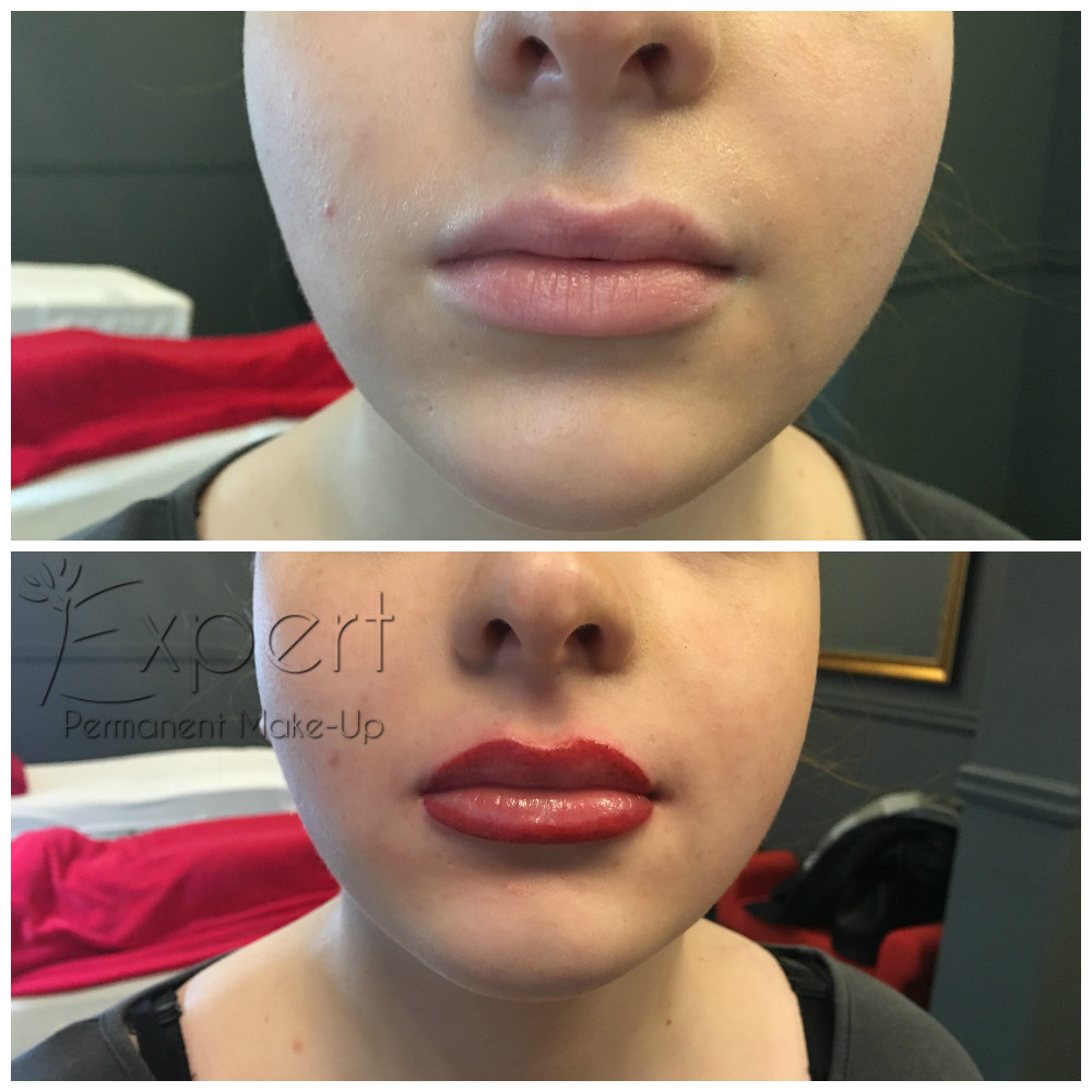 Permanent Make-up - Lippen Vorher-Nachher-Bild 8